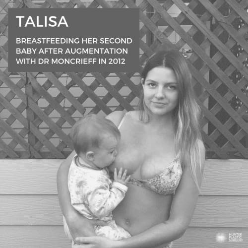 Can I breastfeed after breast implants?